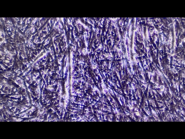 영남대 세포배양연구소에서 현미경으로 관찰한 닭의 근육 줄기세포. 보라색 국수 다발 모양의 줄기세포들이 계속 꿈틀거렸다. 우현지 기자